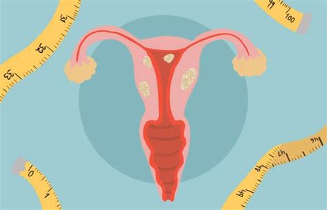 What Could Trigger Enlarged Uterus? 12 Possible Causes - OptingHealth