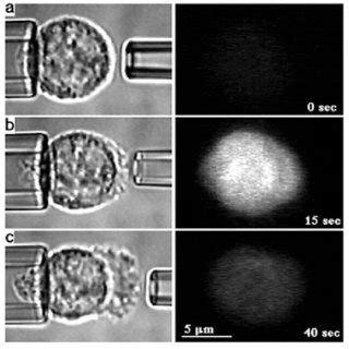 Pseudopod formation after the exposure of a single neutrophil to 10 −6... | Download Scientific ...