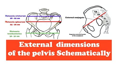 Pelvic Outlet Measurements