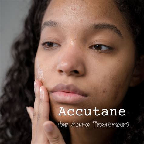 Accutane for Acne Treatment | Dr. Kally Papantoniou