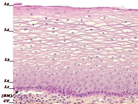 Intermediate Cells