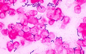 Enterococcus faecalis