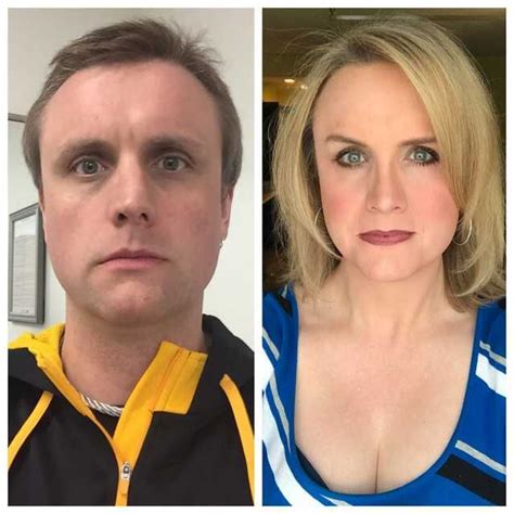 45 - 2Yrs HRT. - Imgur Transgender Before And After, Mtf Before And After, Mtf Transition ...