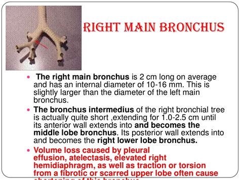 Anatomy of tracheobronchial tree