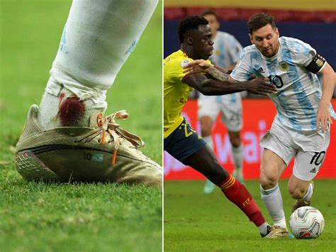 lionel messi ancle injury: Lionel Messi injured during the Copa America semifinals match against ...