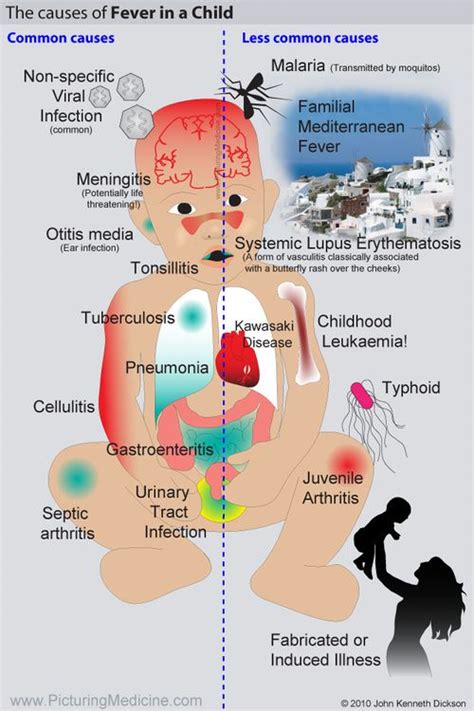 Causes of Fever in a Child | Pediatric nursing, Pediatric nurse ...