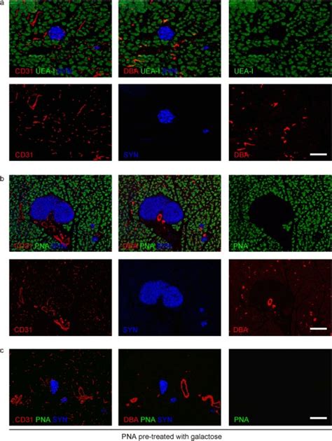 PNA lectin for purifying mouse acinar cells from the inflamed pancreas ...