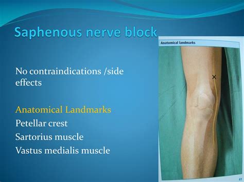 PPT - Peripheral Nerve Blocks using Nerve Stimulator PowerPoint Presentation - ID:6587417