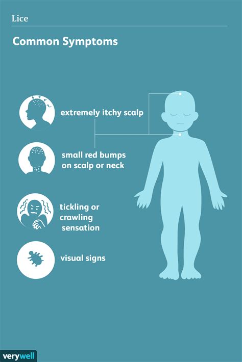 Head Lice Symptoms: How to Tell if You Have Lice