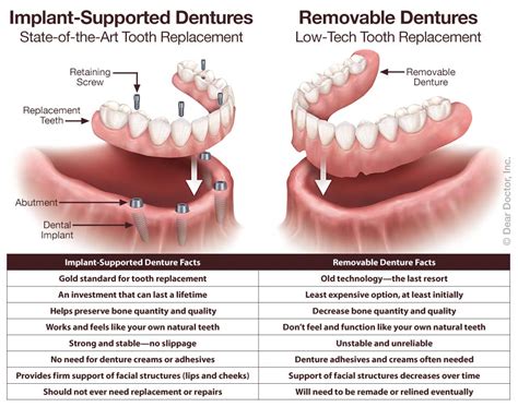 Dentures | Elko Dental Care | Elko Nevada