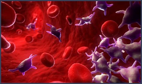 VIDEO: New Guidelines for Platelet Transfusions from the AABB