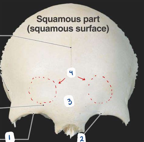 orofacial anatomy: skull anatomy (addy) Flashcards | Quizlet