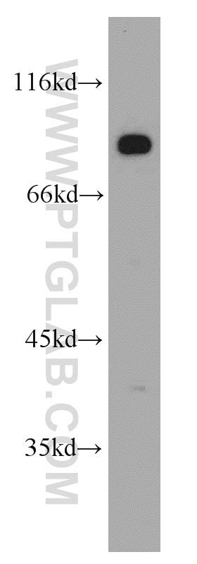 DLL4 antibody (21584-1-AP) | Proteintech