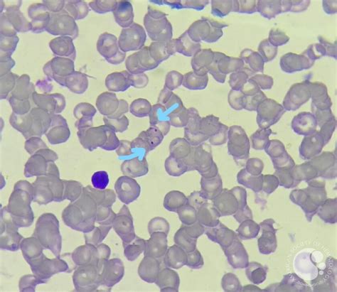 Plasmodium falciparum trophozoites 2