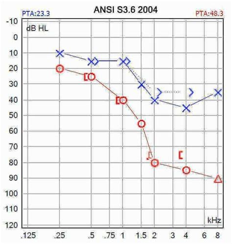 How to read the audiogram by yourself - AZ Hearing