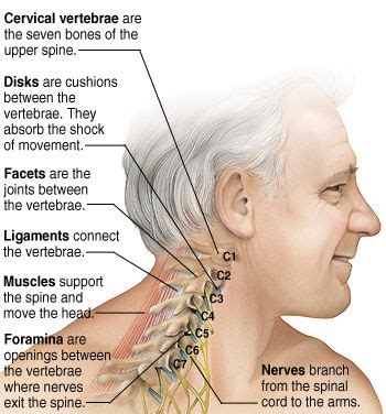 Cervical Spine | Chiropractic | Pinterest | Neck pain, Chiropractic and Chronic pain