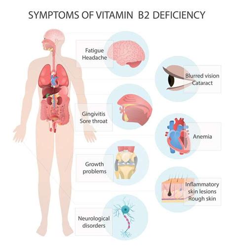 Vitamin B2: Key Role, Sources, Deficiency & Side Effects | Femina.in