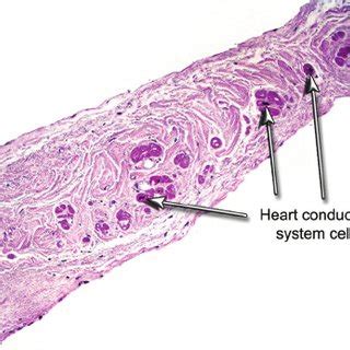 (PDF) The Thebesian valve and its significance for electrophysiologists