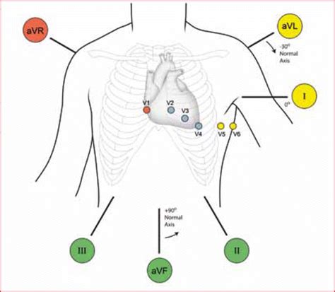 12 Lead Ecg Placement Color Coded