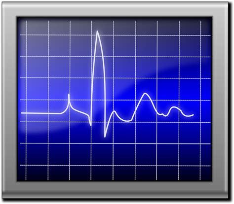 Pulse,heartbeat,pulsation,beat,ekg - free image from needpix.com