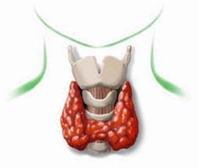 mimiportillo: Cretinism - Symptom, Causes, Treatment of Cretinism