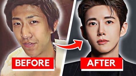 Korean Celebrities Before And After Plastic Surgery