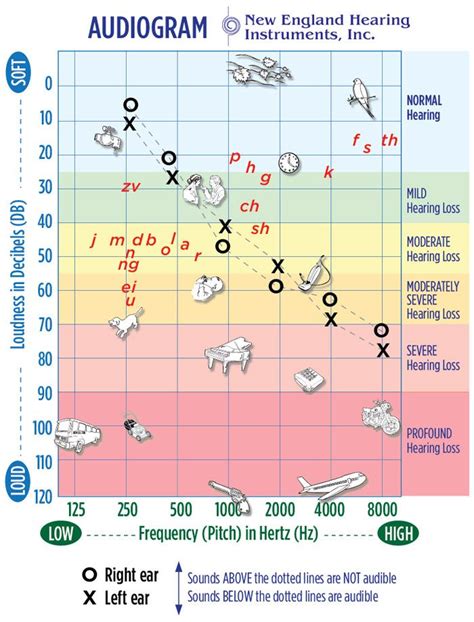 Audiogram use to chart hearing loss. It's good to have your child's ...