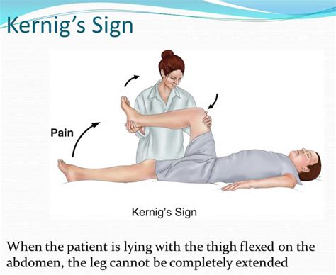 Kernig sign, Brudzinski sign, how to perform Kernig and Brudzinski test