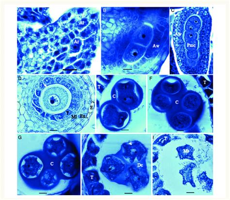 Microsporogenesis in M. esculenta. (A) Formation of archesporium (Ar).... | Download Scientific ...