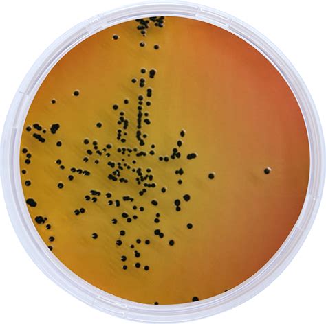 SALMONELLA SHIGELLA AGAR | Agarindo Biological Company