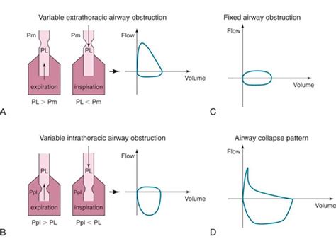 Flow Volume Loops In Spirometry | Porn Sex Picture