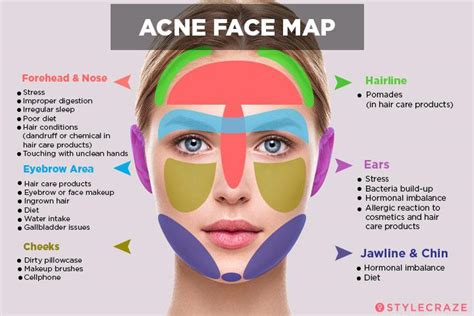 Stress Acne Face Map