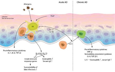 Atopic Dermatitis Pathway