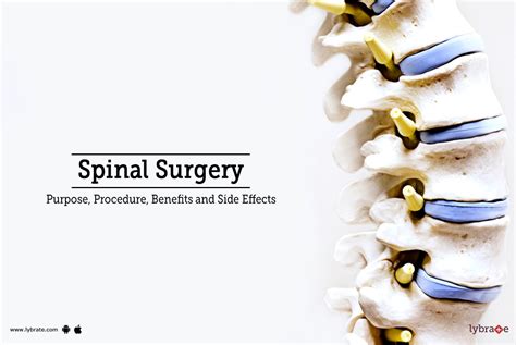 Spinal Surgery: Types, Recovery, Risks, and Benefits