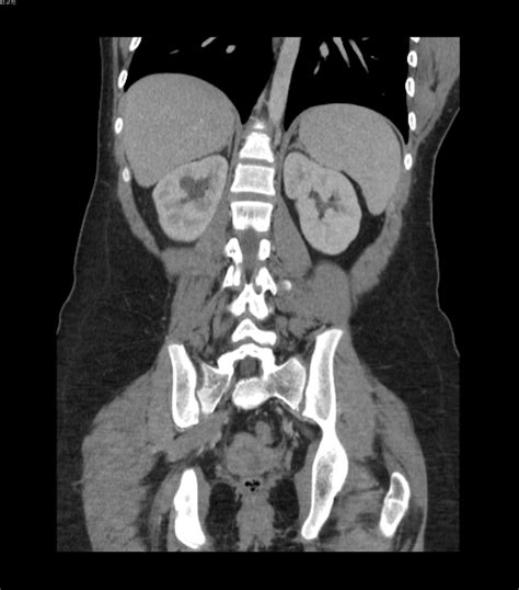 Ask Dr. M: What’s the difference between an X-ray, CT scan, ultrasound, and MRI?