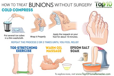 how to treat bunions without surgery Bunion Exercises, Foot Exercises, Health Info, Health And ...
