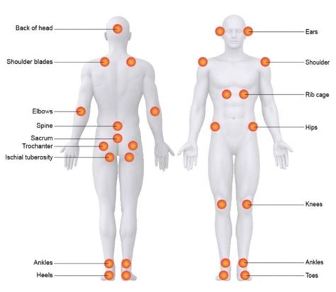 common pressure sore locations的圖片搜尋結果 | Pressure ulcer, Wound care ...