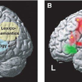 (PDF) Language Acquisition and Brain Development