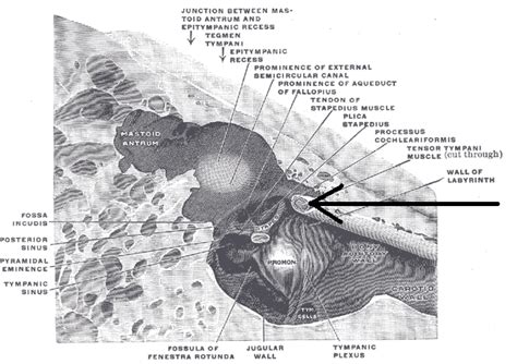 Tensor tympani - wikidoc