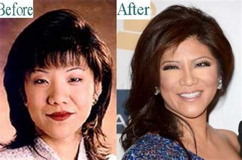 Julie Chen Plastic Surgery Before and After Photos: Nose Job, Face Lift ...