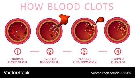 Blood Clotting Diagram