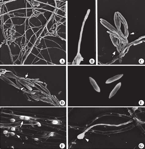 Scanning electron microscopy of ultrastructures of Fusarium solani. (A)... | Download Scientific ...