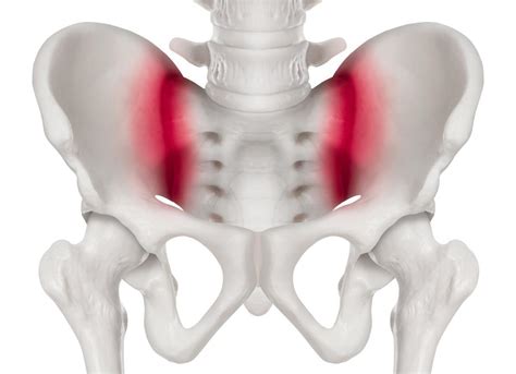 Sacroiliac Joint Injection Treatment - Plainsboro Township, NJ & Freehold, NJ: Regenerative ...