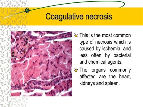 PPT - Cell damage: necrosis, apoptosis. General D eath PowerPoint Presentation - ID:3767551