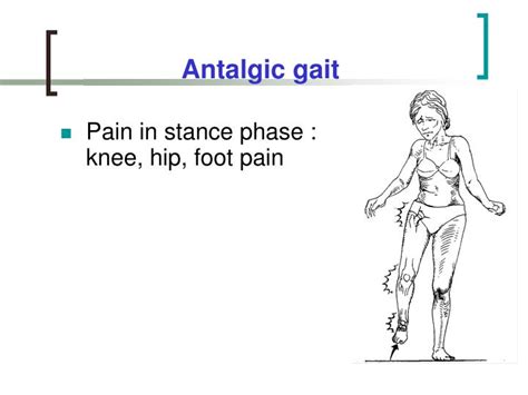 PPT - Gait & Gait Aids PowerPoint Presentation - ID:1120864