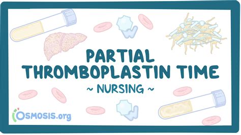 Coagulation studies - Partial thromboplastin time (PTT): Nursing: Video & Causes | Osmosis