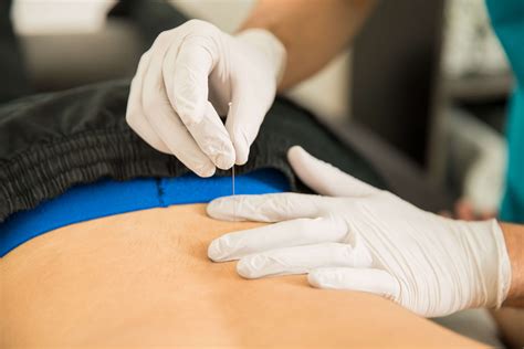 Muscle Pain Therapy | Dry Needling | Franklin Rehabilitation