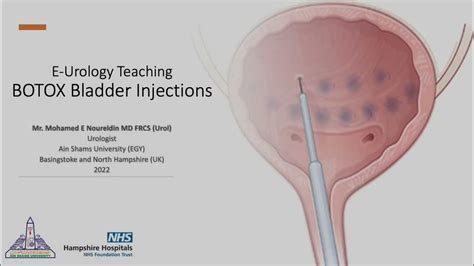 BOTOX Bladder Injections - YouTube