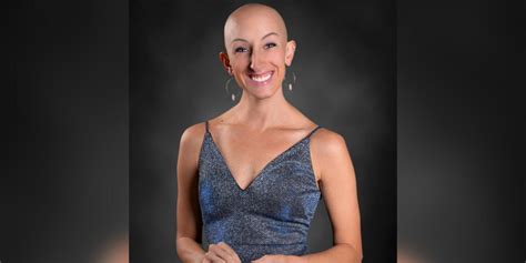 Why Losing My Hair to Alopecia Was the Best Thing to Happen to Me | The Mighty