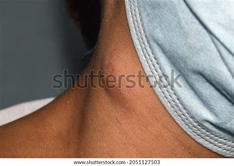 81,944 Big Neck Images, Stock Photos & Vectors | Shutterstock